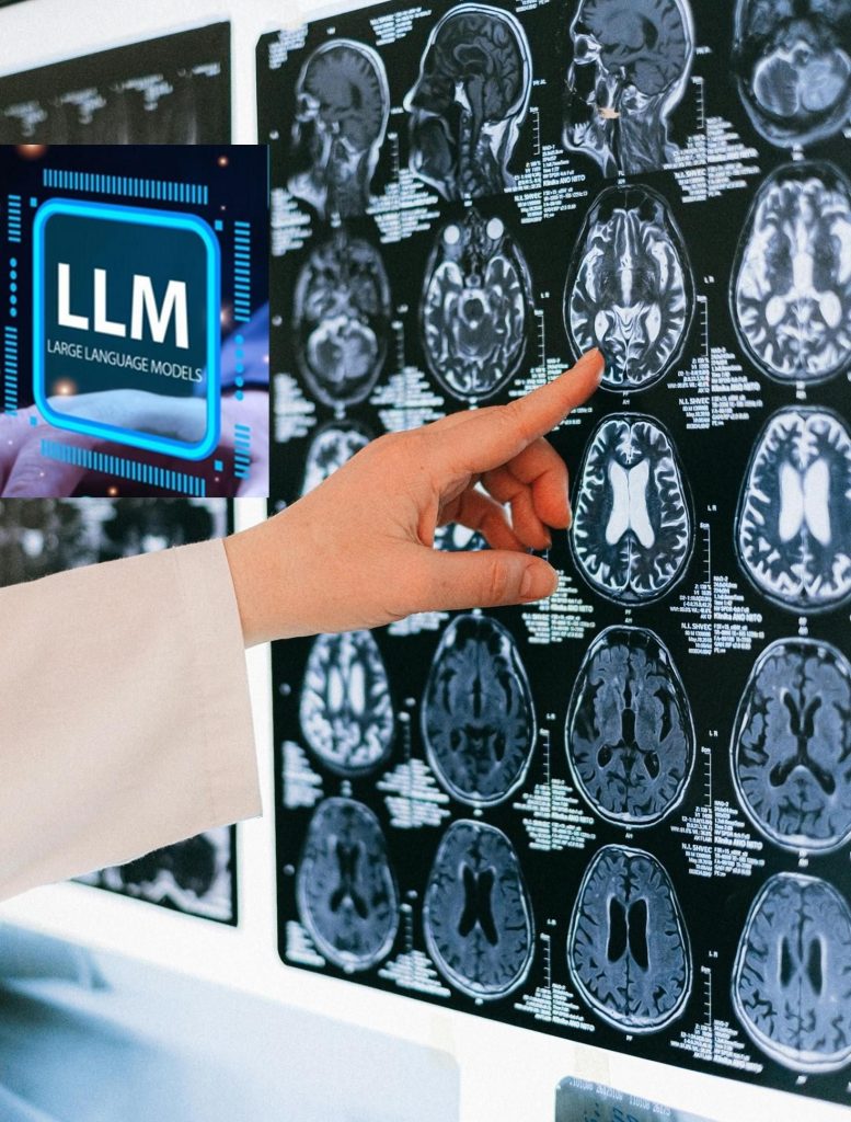 大型語言模型(LLMs)對神經科護理品質與效率的影響